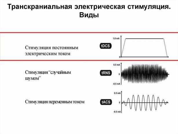 Je možné zlepšiť pamäť elektrinou?