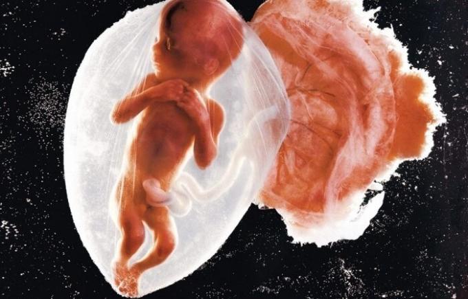 Prvé fotografie dieťa embryo.