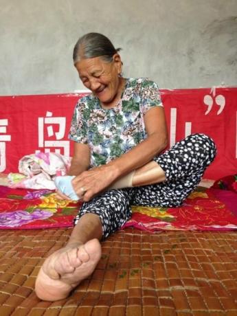 Obete čínskeho krásy, ktorí majú prekvapivo malé nohy. / Foto: interesnoznat.com. 